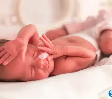 شیردهی به نوززاد ، نوزادان نارس ، نوزاد نارس
