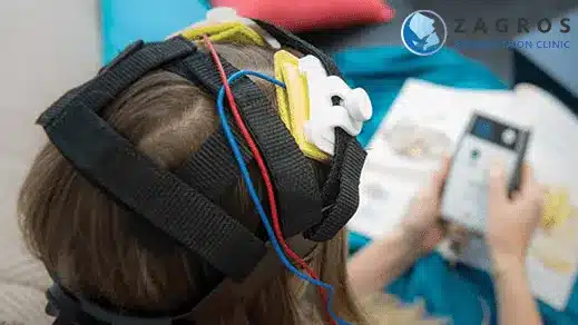مزایای درمان افسردگی با tDCS ، درمان افسردگی با tDCS ، دستگاه tdcs