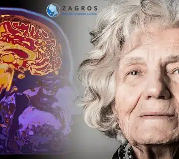 تفاوت دمانس و آلزایمر، دمانس، زوال عقل
