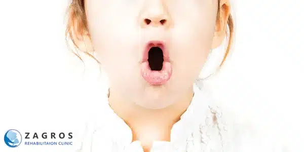 آپراکسی ، آپراکسی گفتار ، آپراکسی رشدی گفتار