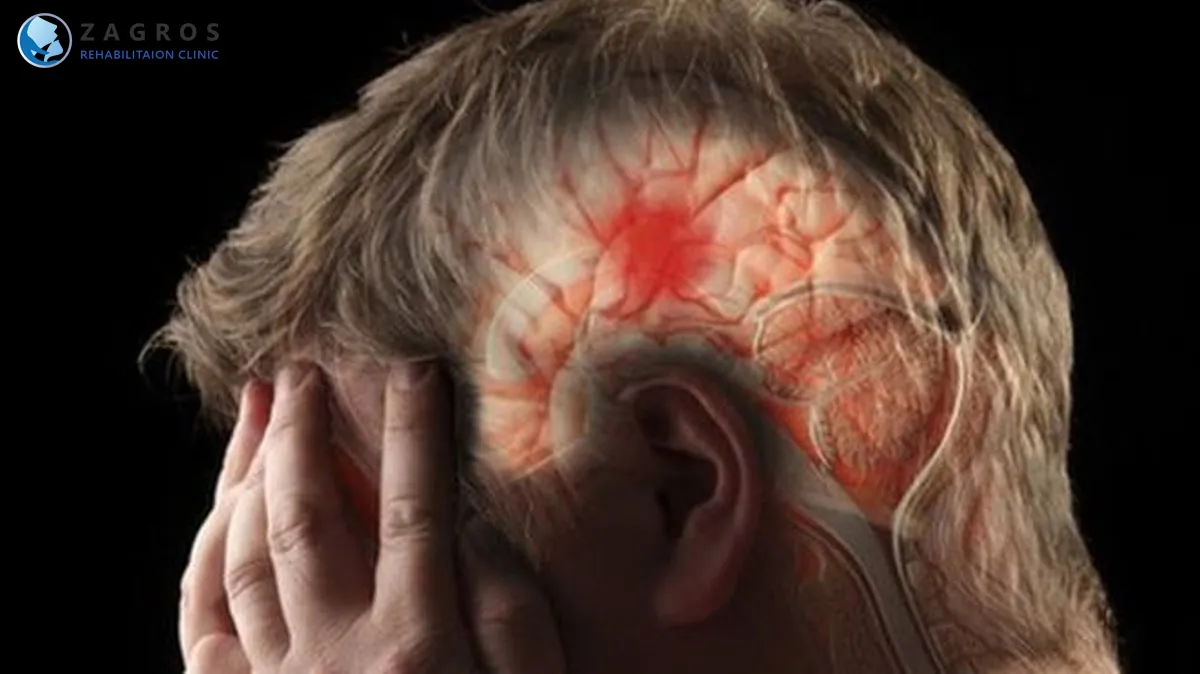 روز جهانی سکته مغزی 9 تاریخچه روز جهانی سکته مغزی ،