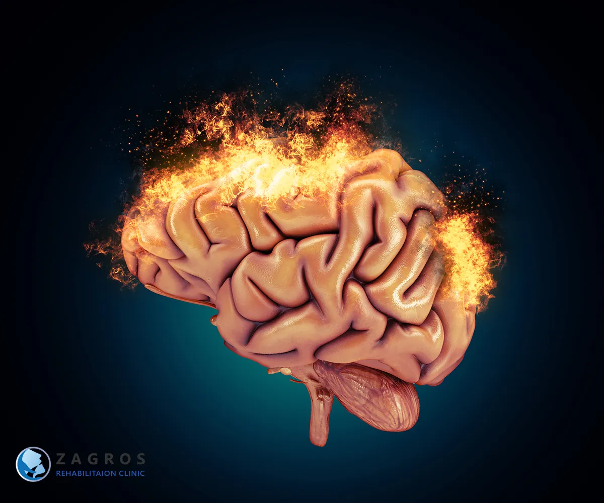 روز جهانی سکته مغزی 11 توانبخشی بعد از سکته مغزی ، درمان سکته مغزی ، پیشگیری از سکته مغزی ، روز جهانی سکته مغزی